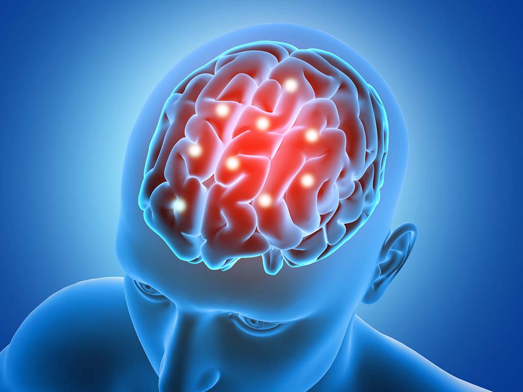 Brain.jpg Brain.jpg